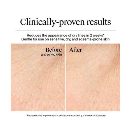 Neutrogena Hyaluronic Acid Gel Cream for Normal to Dry Skin Fragrance Free 50ml