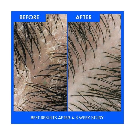 Head & Shoulders Classic Clean Anti-Dandruff Shampoo 835ml