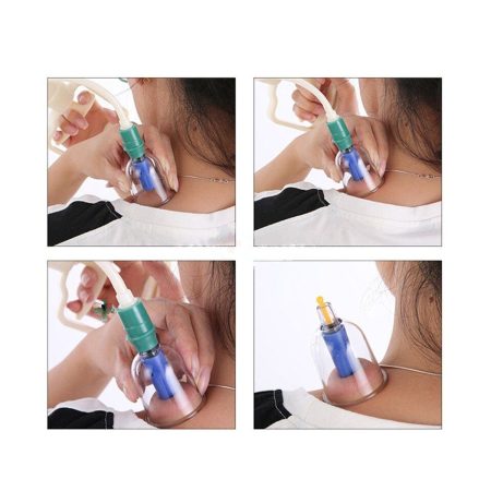 Chinese Health Care Medical Vacuum Body Cupping Therapy Set – 32 Pieces with Suction Pump