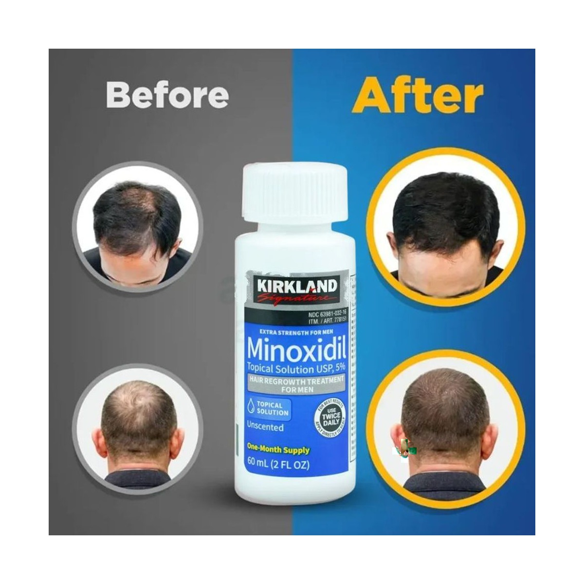 Kirkland 5% Minoxidil Extra Strength Hair Loss & Hair Regrowth Treatment for Men 60ml